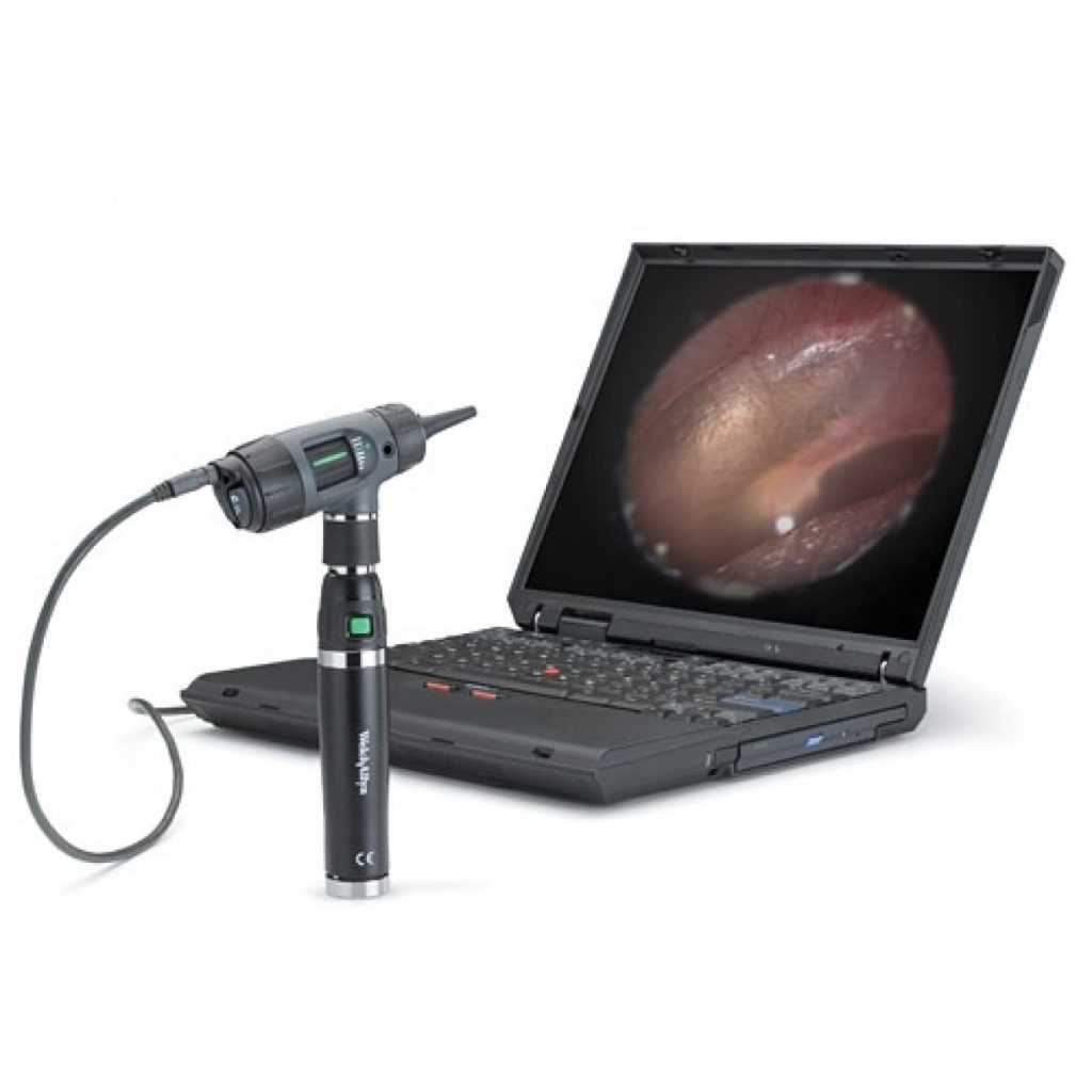 MACROVIEW DIGITAL OTOSCOPE 3.5V BY WELCH ALLYN סט מאקרוויו דיגטלי | בע ...