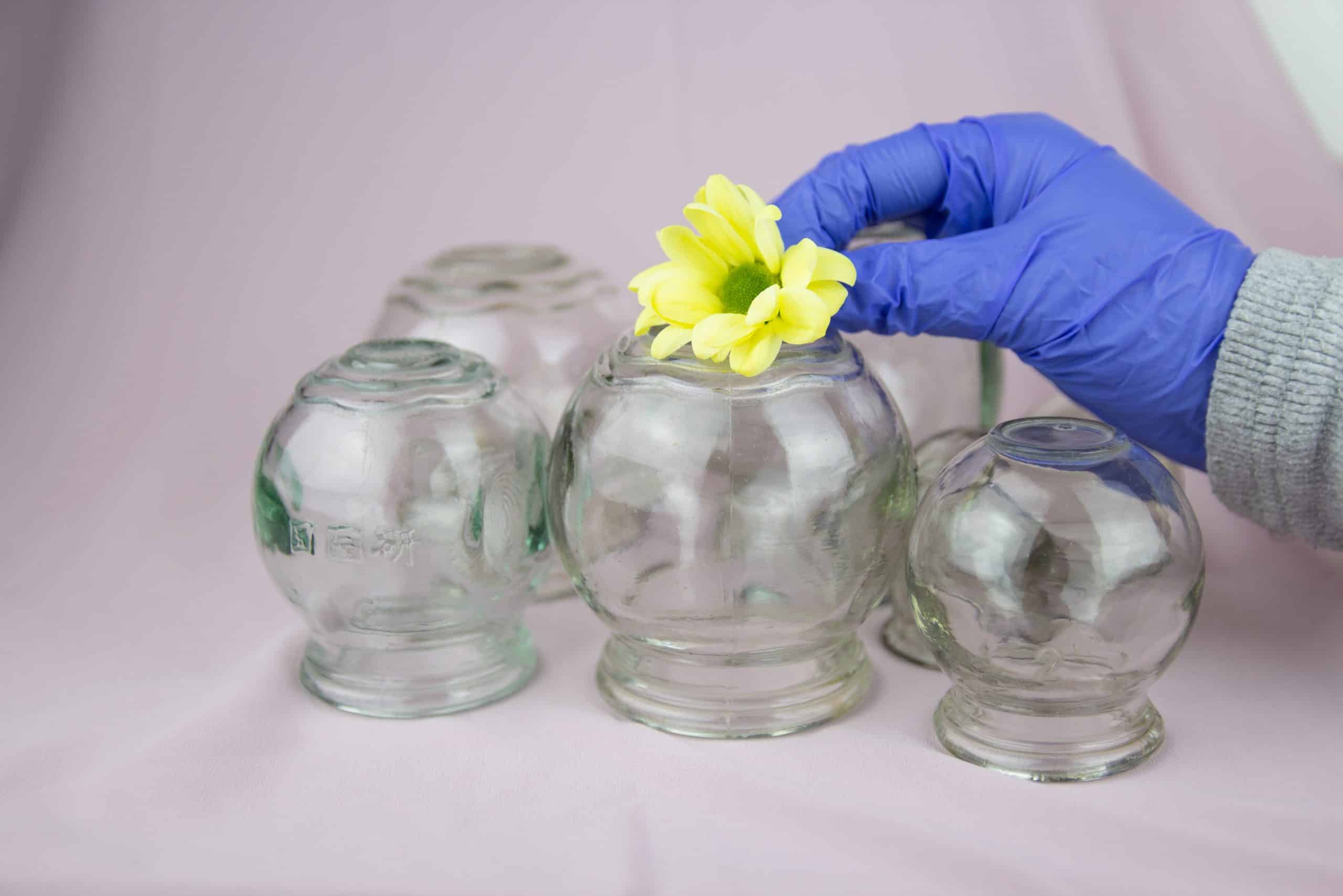 Glass jars for hijama. Yellow flowers. Bloodletting. Sunnah treatment. Islam.