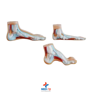 מודל כף רגל אנטומי – NORMAL, FLAT AND ARCHED FOOT